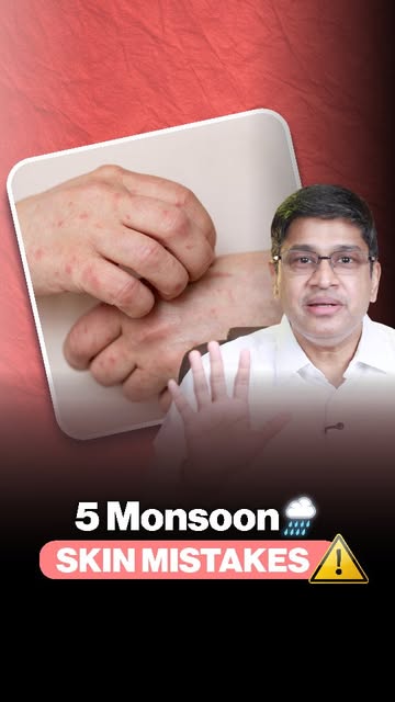 Don’t let the monsoon ruin your skin health! 🌧️❌ From skipping sunscreen on cloudy days to staying 