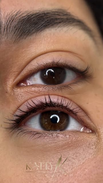 Sometimes you just need the right detail to emphasize your beauty🤗
Subtle definition that makes you