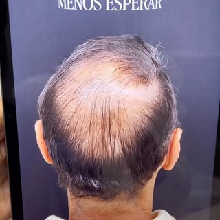 Quando menos esperar… clareou! 🤍 Recuperação capilar de verdade, com dedicação, tratamento certo e 