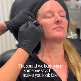 Filler doesn’t make you look fake.⁠
Bad filler does.⁠
⁠
When it’s done right, it should look balance