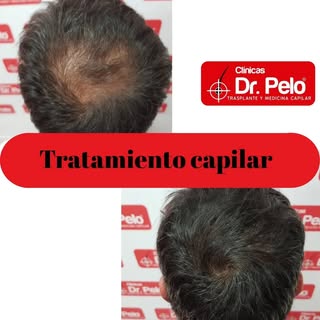 Cuando el diagnóstico es correcto, el pelo puede cambiar por completo.

A veces pensamos que la únic