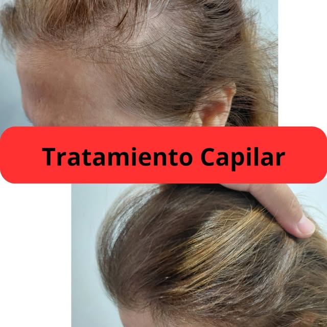 MÁS DENSIDAD. MÁS COBERTURA. UNA DIFERENCIA QUE SE VE.

Este antes y después muestra la evolución tr