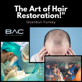 In conclusion, a hair transplant is a surgical procedure that effectively addresses hair loss and ba