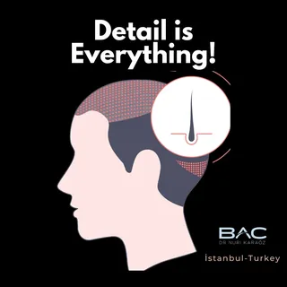 Welcome to our state-of-the-art hair transplant center in Turkey!

Hair Transplantation in Turkey: A