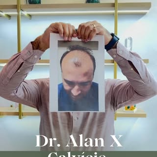 Até o próprio doutor Alan já passou pelo desafio da calvície!

Antes do transplante, ele também sabi