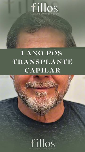 Existe planejamento, técnica, acompanhamento, cuidados e, principalmente, tempo para que a transform