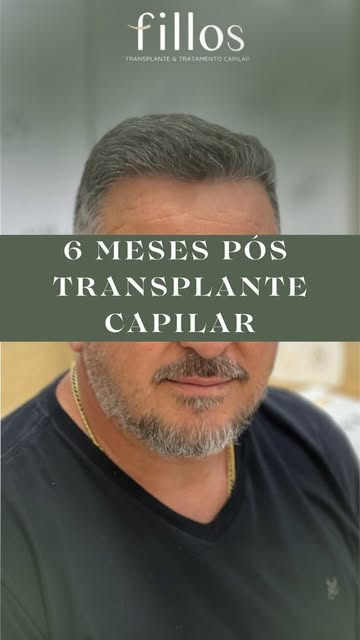 O resultado que você vê em pouco segundos foi construído ao longo de meses!

Responsável técnica: Dr