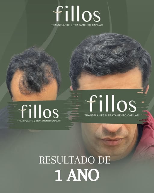 Um ano dá para mudar tudo, inclusive a sua autoestima e confiança! Mas o sim, tem que ser dado, hoje