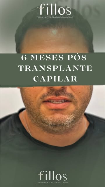 O resultado de 6 meses, fala por si só!! Lembrando que o resultado final é 1 ano

Responsável técnic
