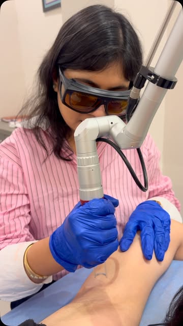 Tired of pigmentation, dark spots, and uneven skin tone? ✨

Experience advanced Tri-Beam Laser Treat
