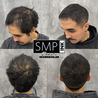 Thinning hair? You’ve got options.

SMP Density treatments are designed for both men and women looki