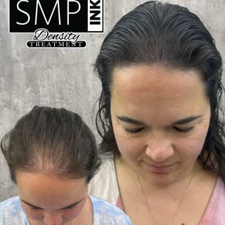 For many women, hair is deeply connected to identity, femininity, and confidence.

When hair begins 
