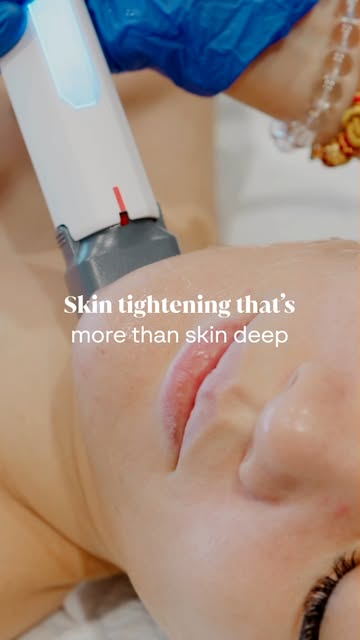 ✨ TAMPA BAY, MEET XERF™ ✨

The next generation of skin tightening has arrived at New Tampa Wellness 