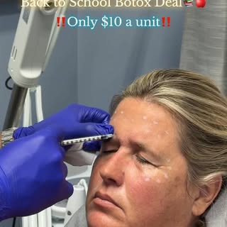 📚✨ BACK-TO-SCHOOL BOTOX DEAL! ✨💉

Get ready for back-to-school with a little refresh! 💕 Get your 