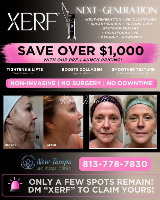 🔥 SKIN TIGHTENING HAS EVOLVED. MEET XERF™. 🔥

The NEXT GENERATION of RF skin tightening has arrive