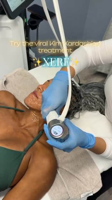 Wesley Chapel, meet your new obsession 👀✨

XERF is one of the treatments Kim Kardashian loves—and n