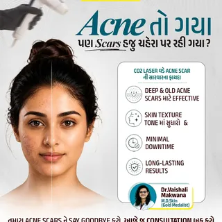 Acne તો ગયું… પણ Scars હજુ પણ રહી ગયા? 😟
Acne scars માટે યોગ્ય treatment સાથે skin texture અને appe