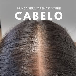 "Nunca será apenas sobre cabelos..."

Essa paciente jovem enfrentava uma queda capilar aumentada, qu