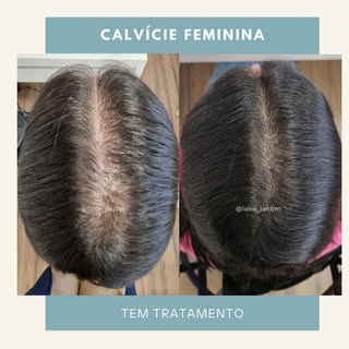 Um antes e depois que enche o coração de esperança! 🙏

Este é o resultado de um tratamento elaborad