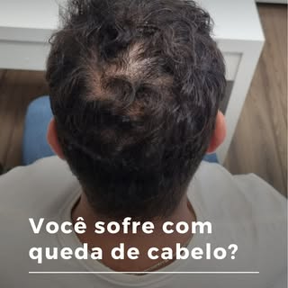 Você sofre com queda de cabelo? 🔴

Não ignore os sinais! Seu problema de cabelo pode ser resolvido 