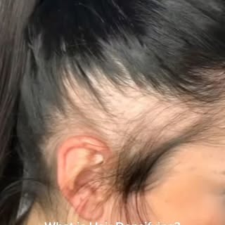 👇🏼

Wenn Sie dünnes Haar, Alopezie oder nach einer Haartransplantation nicht genügend Haardichte u