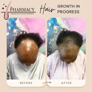 ✨ This is your sign to begin your healing and hair growth journey with a Certified Trichologist by y
