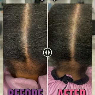 Holistic hair care looks at the whole picture! Internal factors like gut health can trigger scalp is