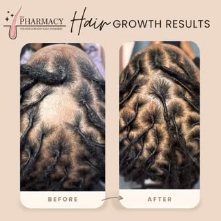Real hair restoration starts on the inside. 🌱✨ The truth is: when it comes to hair loss, treating t