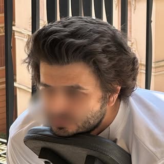 He came in wanting a hairline that turned heads — not because it looks transplanted, but because it 