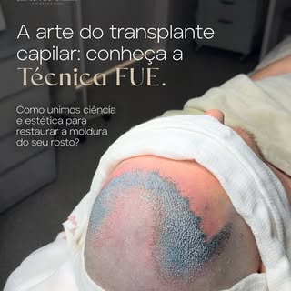 Recuperar o seu cabelo é uma decisão que vai além da estética. É sobre retomar a sua identidade.

O 
