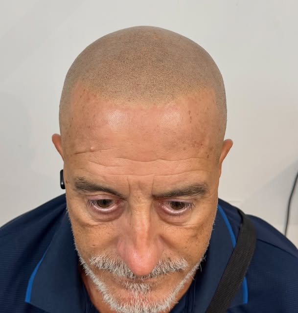 ✨ Un cambio que va mucho más allá de la imagen.

Hoy os presentamos el resultado de Fran ,que decidi