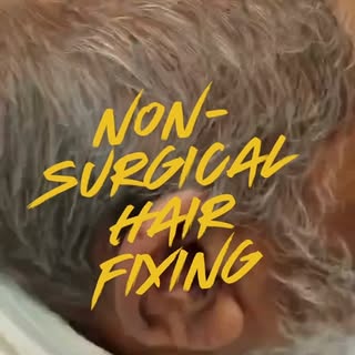 ✨ Confidence Has No Age Limit! ✨

👨‍🦳 Non-Surgical Hair Fixing for Men

A natural transformation f
