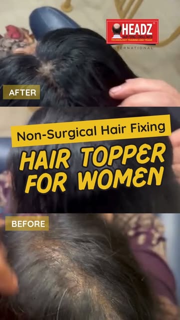 ✨ Add Volume. Add Confidence. Be You. ✨

Discover Hair Toppers for Women by HEADZ Hair Fixing — a sm