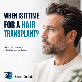 Wondering when it may be time to consider a hair transplant?

A hair transplant may be an option whe