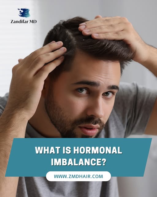 What is Hormonal Imbalance?⠀
⠀
Before delving into how hormonal imbalances affect hair growth, it’s 