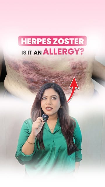Think it’s an allergy? Think again. 

Painful, water-filled blisters on one side of the body could b