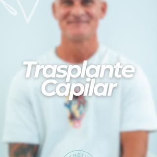 Emilio comparte su experiencia en Clínica Oliva tras su trasplante capilar, destacando no solo su sa