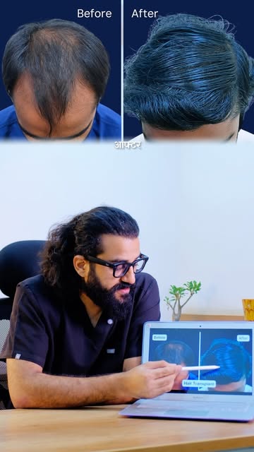Hair loss is not just about losing hair — for many people, it can affect confidence, appearance, and