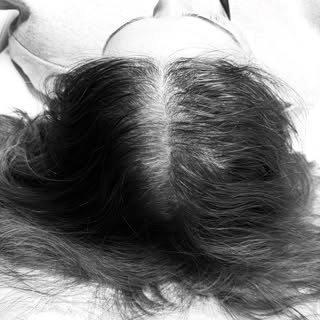 Women’s scalp micro pigmentation after 1 session, we have 2 more sessions to go!

Photo 1: left side