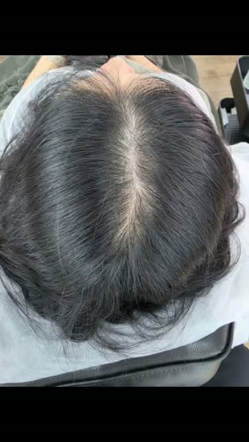 Say goodbye to visible parting line scalp exposure!

When female pattern hair loss or diffuse thinni