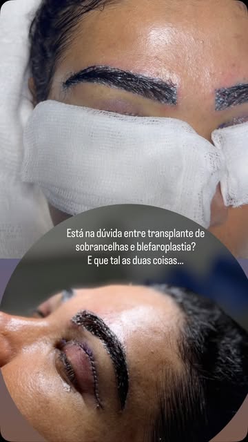 Cada resultado é único e feito exclusivamente pra você!

Gostou? Comente quero que entraremos em con