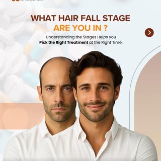 🚨 Hair fall doesn’t happen in ONE day… and neither should your treatment.
From early thinning to vi