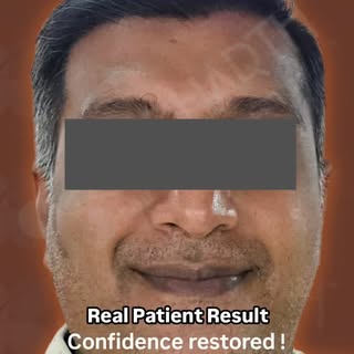 Hair loss can change how a person feels.

Restoring Hair Restores Confidence.

📍 Siddharth Hair Tra