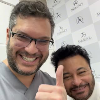 O topete do Silvio ficou sensacional 😀.
Cirurgia com alta densidade, naturalidade e resultado após 