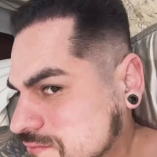 O David tirou fotos 🤳🏻 diárias desde o dia da cirurgia até o 5o mês. 

O resultado já apresenta mu