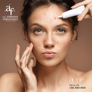 ¿Sabías que el acné del adulto es cada vez más frecuente?

Muchas personas prueban productos durante