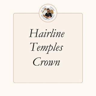 It’s not just about adding hair.
It’s about restoring symmetry, framing the face, and bringing confi
