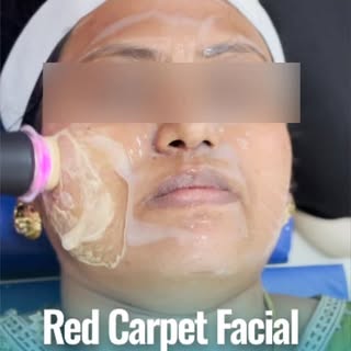 ✨ RED CARPET FACIAL ✨
Because your skin deserves a star treatment. 🌟

Reveal instantly radiant, hyd