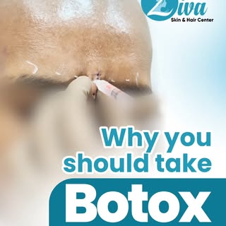 ✨ Did you know?

Injecting botulinum toxin after scar revision surgery can help improve scar outcome