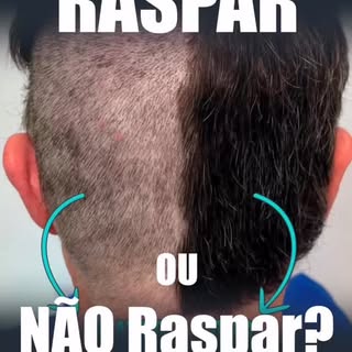 Técnica No Shave & Long Hair: É pra todo mundo? 
No Brasil se tornou uma febre a indicação das técni